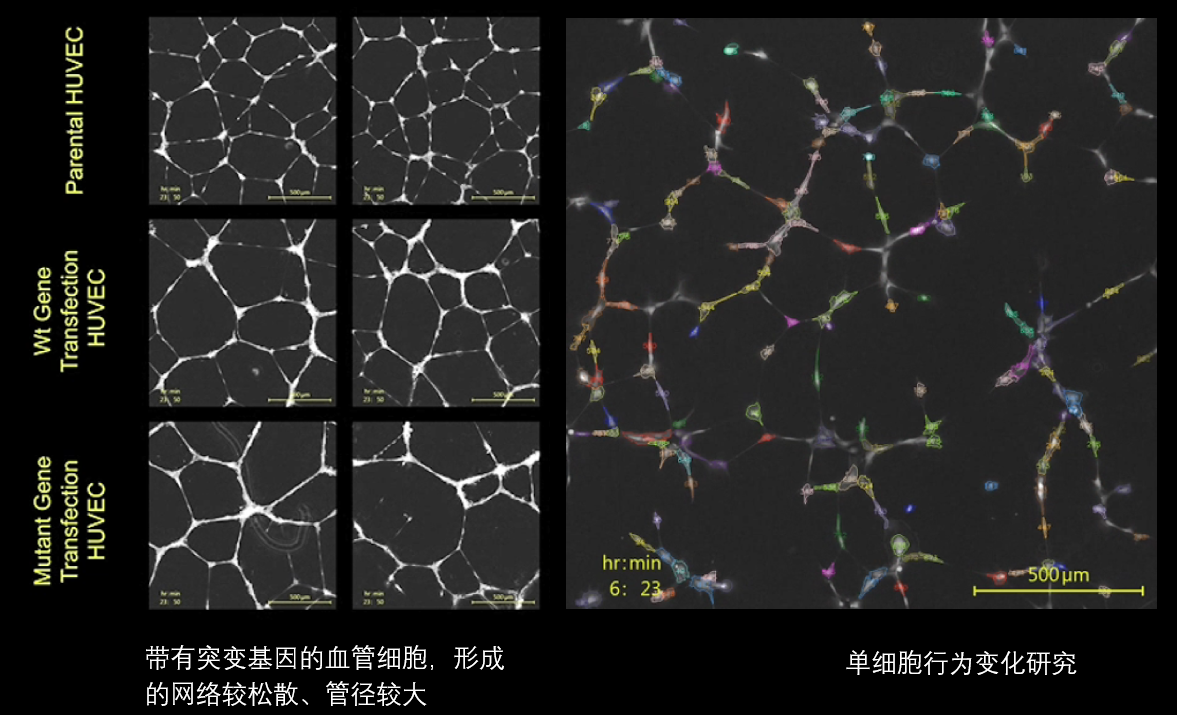 6、血管分析.png
